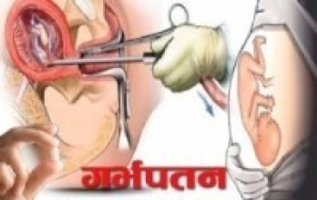 एघार महिनामा एक हजारले गरे गर्भपतन
