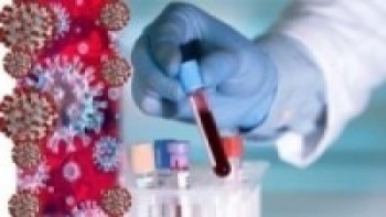 थप एक हजार ३६९ जनामा कोरोना सङ्क्रमण पुष्टि   