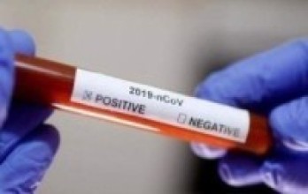 डोल्पामा स्वाब परीक्षण गरिएका पाँचको रिपोर्ट नेगेटिभ