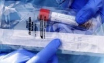 कोरोनाको केन्द्रविन्दु बनेको उदयपुरबाट ९१ स्वाब विराटनगर पठाइयो