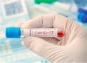 कास्की :‘होम आइसोलेशन’का आठ जनाले जिते कोरोना