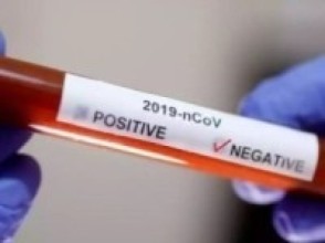 कोरोना अपडेट : सङ्क्रमितभन्दा निको हुने दोब्बर  