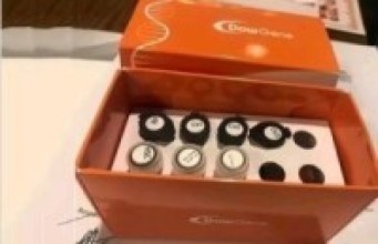 कोरोना सङ्क्रमित पत्ता लगाउने किट्स आइतबार कोरियाबाट आउने