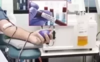 कोरोना सङ्क्रमितको उपचार प्लाज्मा थेरापी विधिबाट गरिने