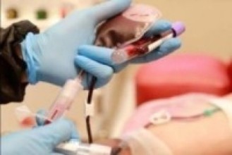 प्लाज्मा थेरापी विधिबाट उपचार शुरु