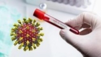 ८३ जनामा कोरोना भाइरस सङ्क्रमण पुष्टि   