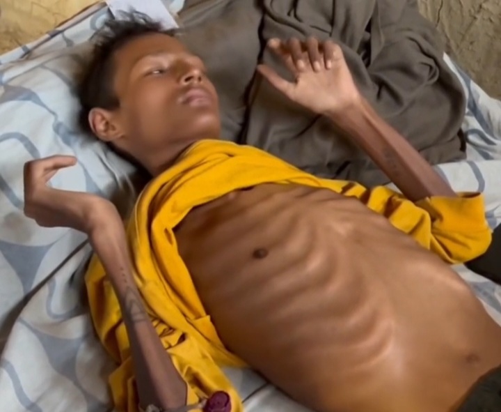 झुपडीमा मृत्युसँग लडिरहेका विजय : जो गरिबीका कारण उपचारबाट बन्चित छन्