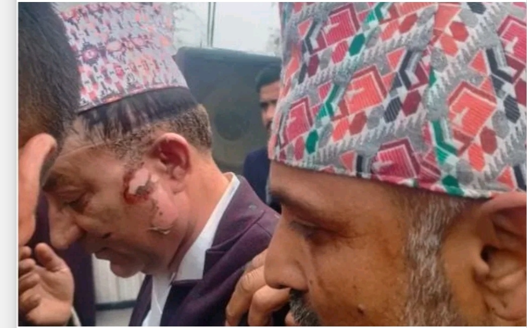 भ्रमण वर्षको उद्घाटन गर्दा बेलुन पड्किएर अर्थमन्त्री र मेयर घाइते,