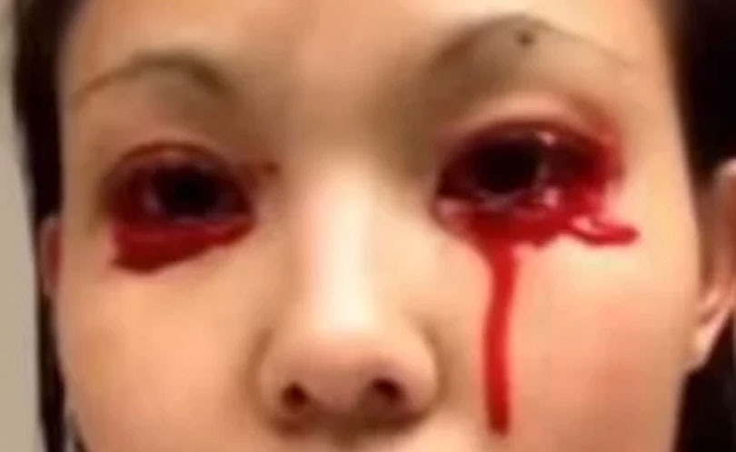 रातमा निस्किन्छ यिनको आँखाबाट रगतको आँशु